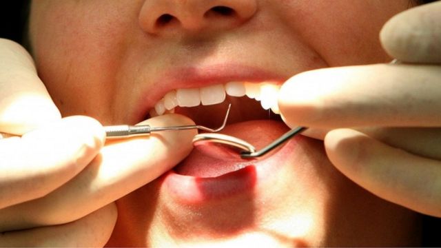 The Importance of Regular Dental Checkups: A Guide for Nigerians
